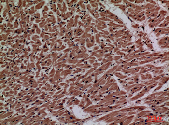 P2X3 Polyclonal Antibody