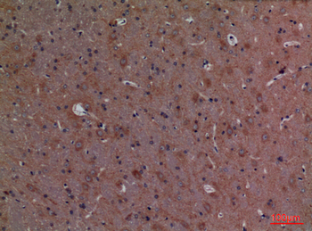 Calbindin D28K Polyclonal Antibody