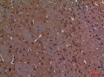 Calbindin D28K Polyclonal Antibody