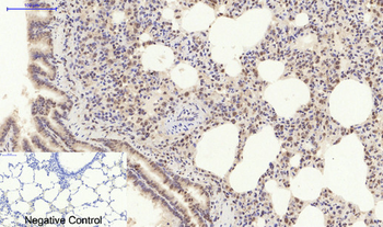 Caspase-3 Polyclonal Antibody