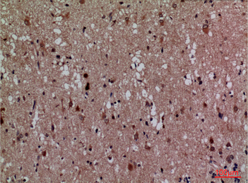 Cdk4 Polyclonal Antibody
