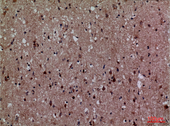 Cdk4 Polyclonal Antibody