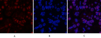 MDM2 Polyclonal Antibody