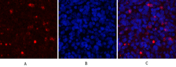 Mcl-1 Polyclonal Antibody