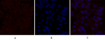 IL-8 Polyclonal Antibody