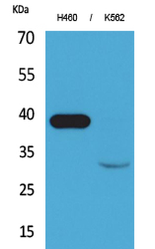 Cathepsin L Polyclonal Antibody