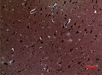 IL-12A p35 Polyclonal Antibody