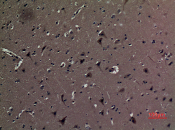 AAT Polyclonal Antibody