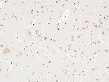 AAT Polyclonal Antibody