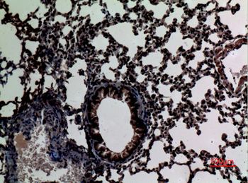 Stat2 Polyclonal Antibody