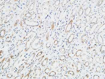 XIAP Polyclonal Antibody