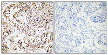 VIP Polyclonal Antibody
