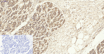 VIM Polyclonal Antibody