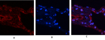 USP11 Polyclonal Antibody