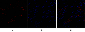 TIMP-1 Polyclonal Antibody