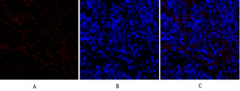 TIMP-1 Polyclonal Antibody