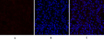 TGFβ1 Polyclonal Antibody