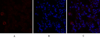 TGFβ1 Polyclonal Antibody