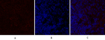TGFβ1 Polyclonal Antibody