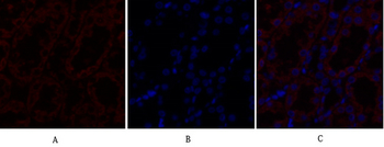 TGFβ RII Polyclonal Antibody