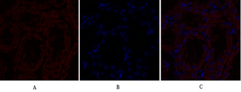 TGFβ RII Polyclonal Antibody