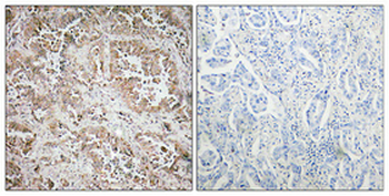 Synphilin-1 Polyclonal Antibody
