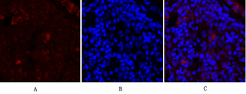 Synapsin I Polyclonal Antibody