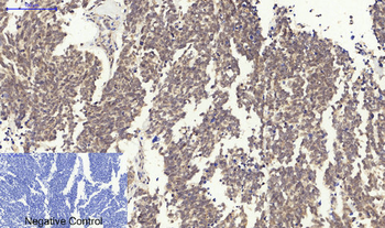Survivin Polyclonal Antibody