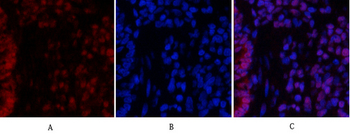 Stat3 Polyclonal Antibody
