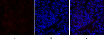 SOCS-1 Polyclonal Antibody