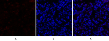 SOCS-1 Polyclonal Antibody