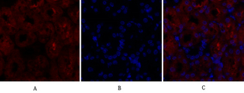 SOCS-1 Polyclonal Antibody