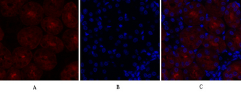 SOCS-1 Polyclonal Antibody