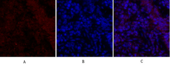 Smad2 Polyclonal Antibody