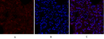 Smad2 Polyclonal Antibody