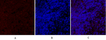 Smad2 Polyclonal Antibody