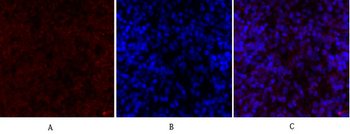 Smad2 Polyclonal Antibody