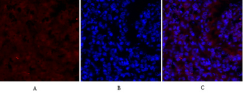 Smad2 Polyclonal Antibody