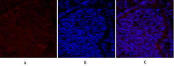Smad2 Polyclonal Antibody