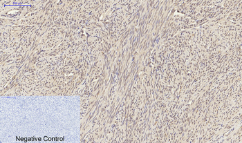 Smad2 Polyclonal Antibody
