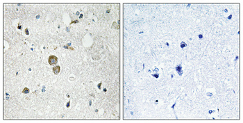 Ribosomal Protein S9 Polyclonal Antibody