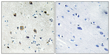 Ribosomal Protein S20 Polyclonal Antibody