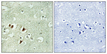 Ribosomal Protein L15 Polyclonal Antibody