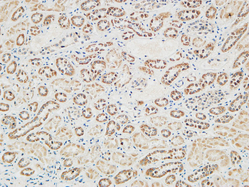 RGS16 Polyclonal Antibody