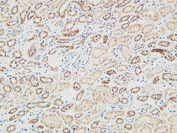RGS16 Polyclonal Antibody