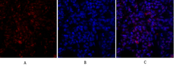 Rb Polyclonal Antibody