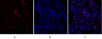 Rb Polyclonal Antibody