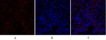 Rb Polyclonal Antibody