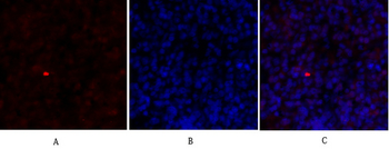 Rb Polyclonal Antibody
