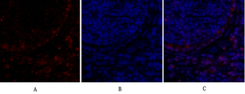 Rb Polyclonal Antibody